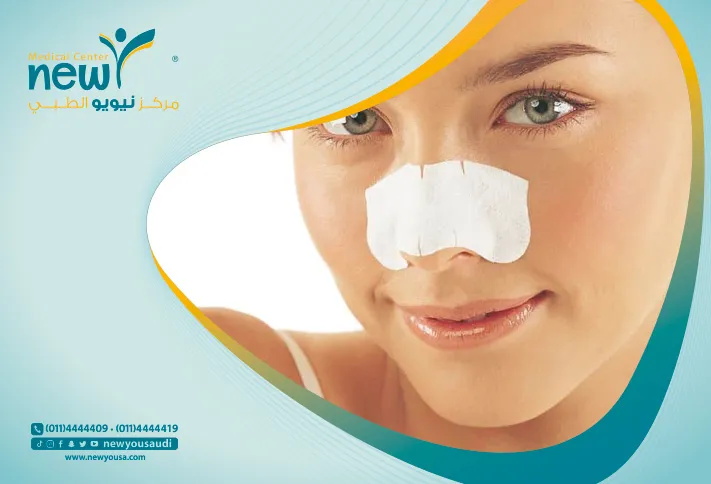 عمليات تجميل الأنف للمراهقين كل ما تريد معرفته عنها من خلال مركزنا الطبي في السعودية | نيويو