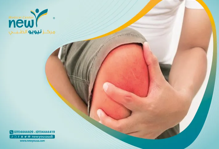 اسباب اسمرار الركب تعرف عليه من خلال مركزنا الطبي في السعودية | نيويو