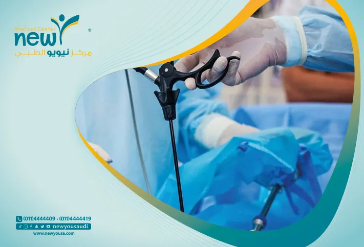 تكميم الرياض في السعودية سعر عملية التكميم كل ما عليك معرفته