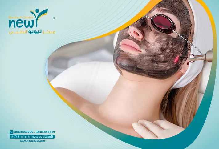 تقشير الوجه بالليزر كل ما تريد معرفته عنه من خلال مركزنا الطبي في السعودية | نيويو