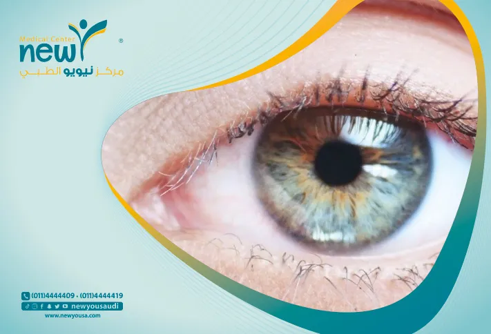 عيون الراكون تعرف عليه من خلال مركزنا الطبي في السعودية | نيويو