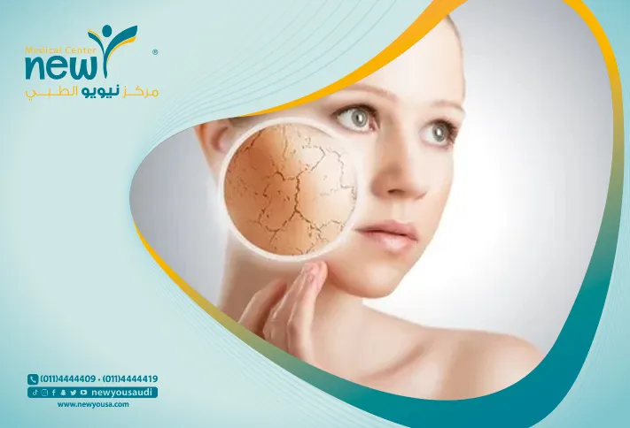 علاج تصبغات الوجه بالليزر تعرف عليه من خلال مركزنا الطبي في السعودية | نيويو