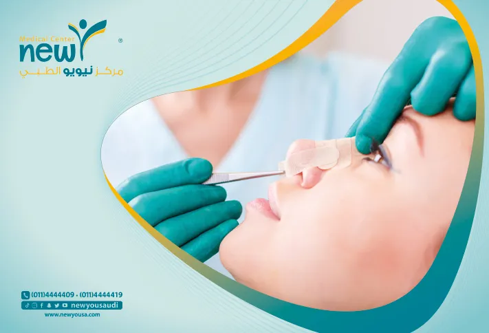 عملية تجميل الأنف بالرياض كل ما تريد معرفته عنها من خلال مركزنا الطبي في السعودية | نيويو