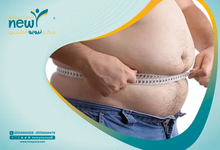 تعرف على الحلول الغير جراحية للسمنة في الرياض مع مركز نيويو