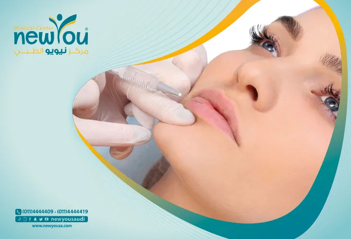 نوع الفيلر الافضل