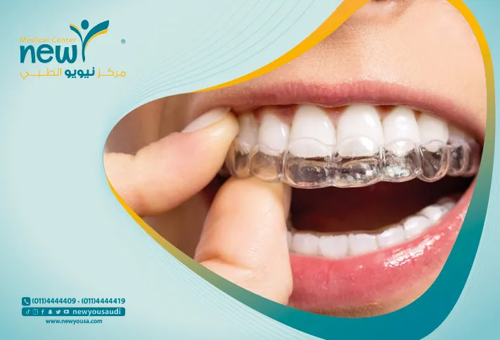 تركيب الأسنان كل ما تريد معرفته عنها من خلال مركزنا الطبي في السعودية | نيويو