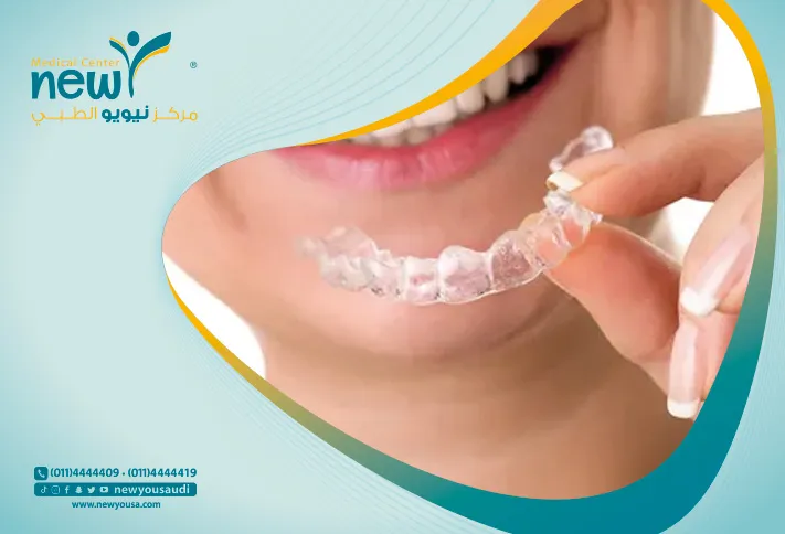 ممزات التقويم الشفاف كل ما تريد معرفته عنه من خلال مركزنا الطبي في السعودية | نيويو