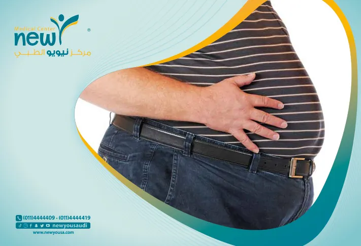 الحلول الغير جراحية لعلاج السمنة كل ما تريد معرفته عنها من خلال مركزنا الطبي في السعودية | نيويو