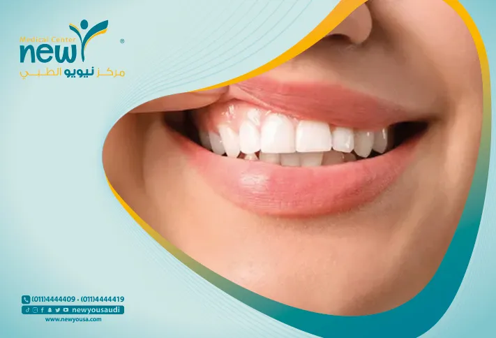 أسباب تصبغ اللثة كل ما تريد معرفته عنها من خلال مركزنا الطبي في السعودية | نيويو