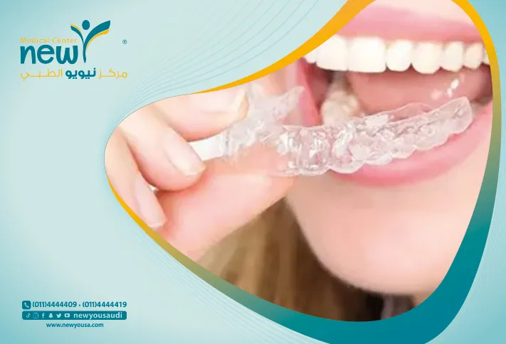 كل ما تريد معرفته عن تقويم اسنان شفاف من خلال مركزنا الطبي في السعودية | نيويو