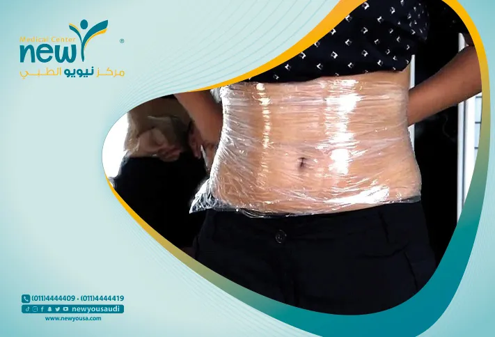 اللف التنحيفي تعرف عليه من خلال مركزنا الطبي في السعودية | نيويو