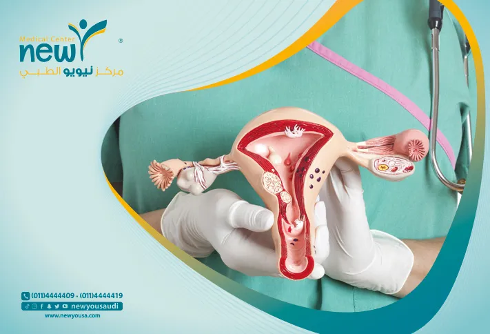 جراحة البروستاتا تعرف عليه من خلال مركزنا الطبي في السعودية | نيويو