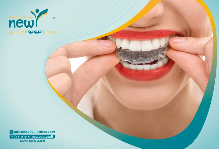 التقويم الشفاف كل ما تريد معرفته عنه و اكثر من خلال مركزنا الطبي في السعودية | نيويو