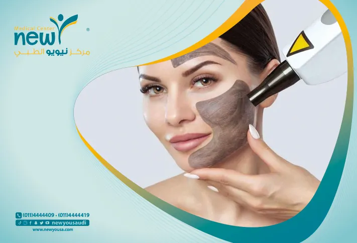 الليزر الكربوني لتفتيح المناطق الحساسه