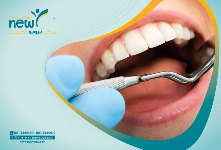 خلع الاسنان تعرف عليه من خلال مركزنا الطبي في السعودية | نيويو