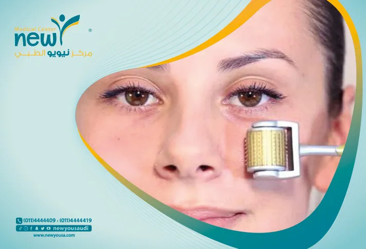 الديرما رولر تعرف عليه من خلال مركزنا الطبي في السعودية | نيويو