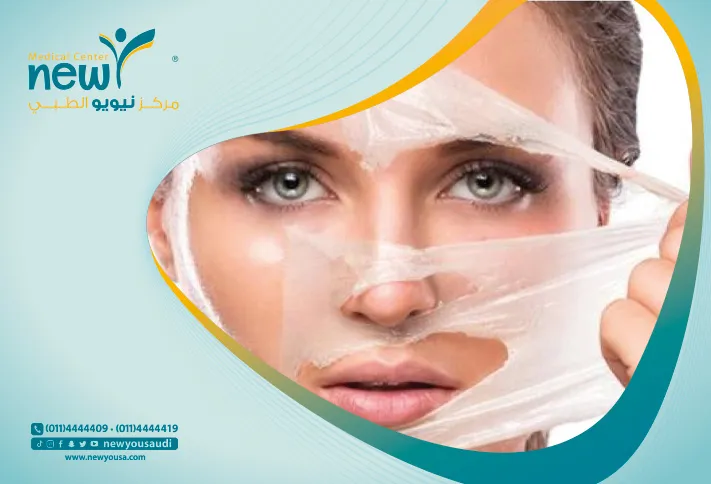 طرق تقشير البشرة تعرف عليه من خلال مركزنا الطبي في السعودية | نيويو