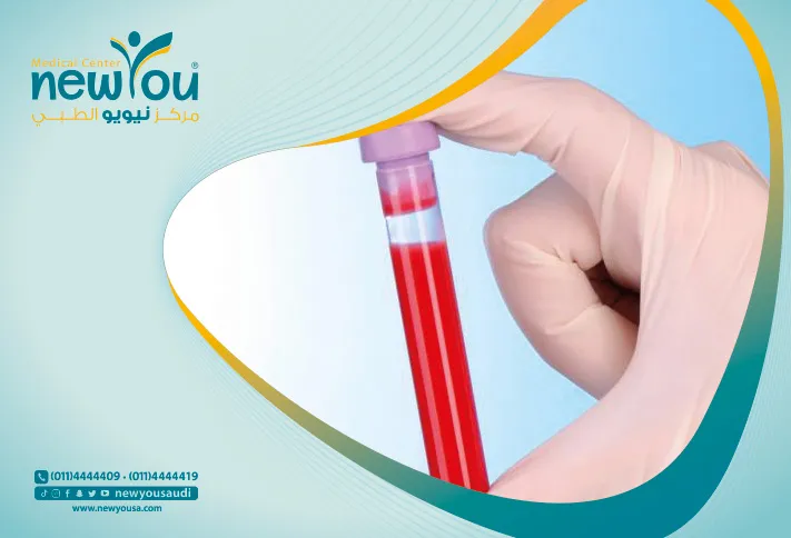 نقص الحديد في الجسم كل ما تريد معرفته عنه من خلال مركزنا الطبي في السعودية | نيويو