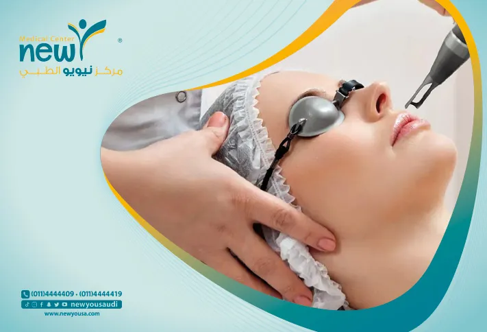 إزالة الشعر بالليزر تعرف عليه من خلال مركزنا الطبي في السعودية | نيويو