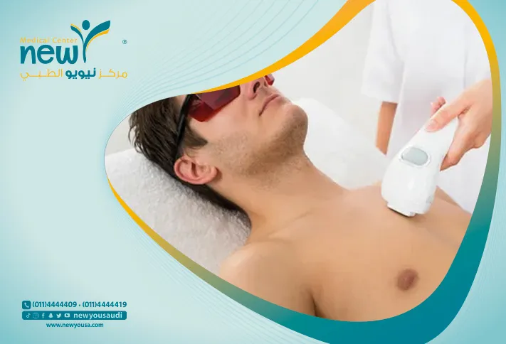 افضل مركز ازالة الشعر بالليزر للرجال - نيويو الطبي