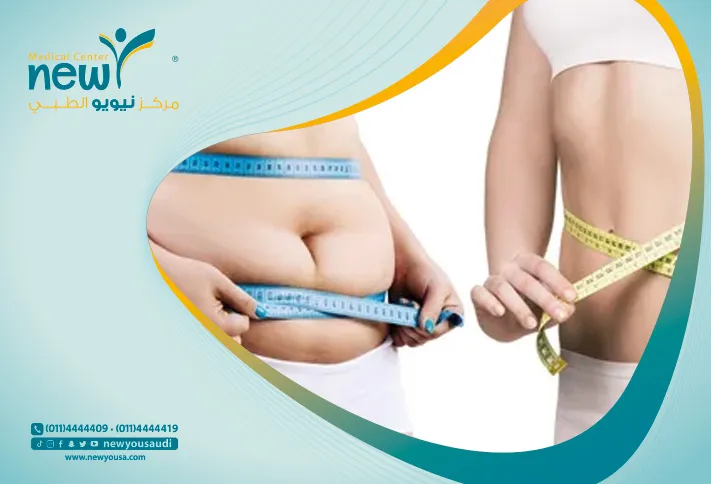 السمنة المفرطة كل ما تريد معرفته عنها من خلال مركزنا الطبي في السعودية | نيويو