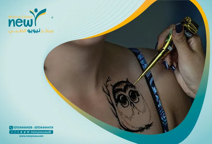 أنواع الوشم تعرف عليه من خلال مركزنا الطبي في السعودية | نيويو