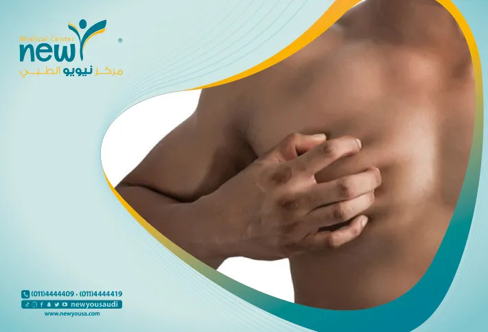 ازالة التثدي