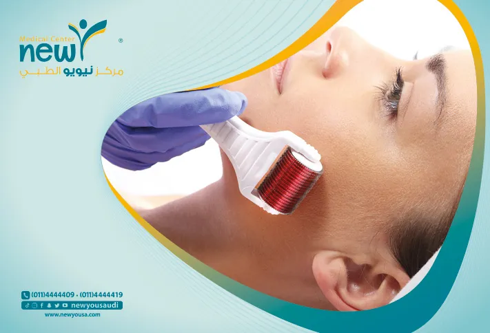 ديرما رولر تعرف عليه من خلال مركزنا الطبي في السعودية | نيويو