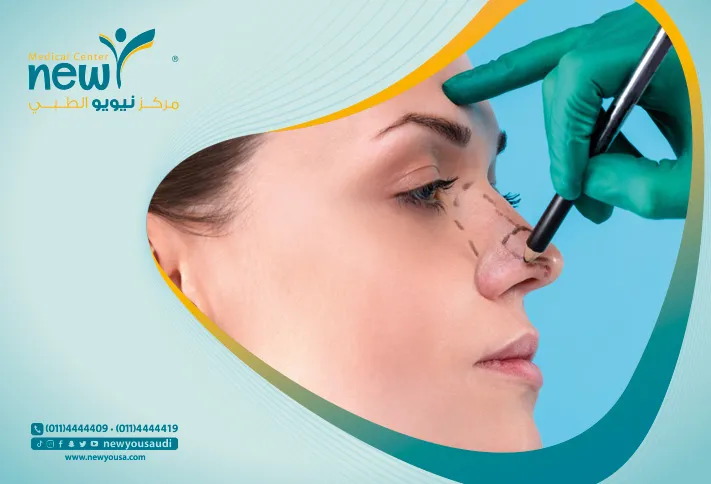 لصقات الأنف بعد الجراحة التجميلية كل ما تريد معرفته عنها من خلال مركزنا الطبي في السعودية | نيويو
