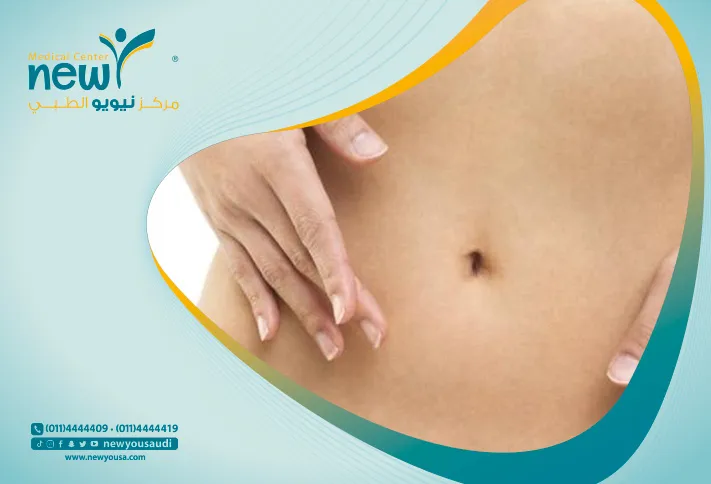 عملية شد البطن كل ما تريد معرفته عنها من خلال مركزنا الطبي في السعودية | نيويو