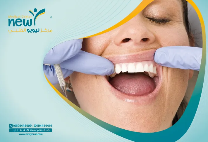 التهاب اللثة كل ما تريد معرفته عنه من خلال مركزنا الطبي في السعودية | نيويو