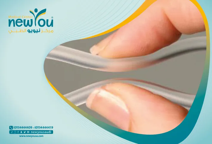 ماهو تضيق المهبل