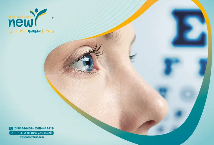تقنيات تصحيح النظر كل ما تريد معرفته عنها من خلال مركزنا الطبي في السعودية | نيويو