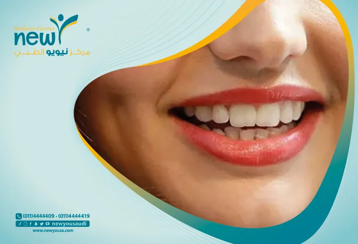 عملية غمازات الوجه من مركز نيويو الطبي بافضل سعر عملية الغمازات في الرياض