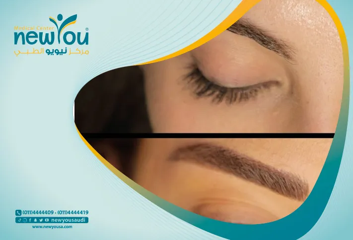 مايكرو بيلدنج الحواجب تعرف عليه من خلال مركزنا الطبي في السعودية | نيويو