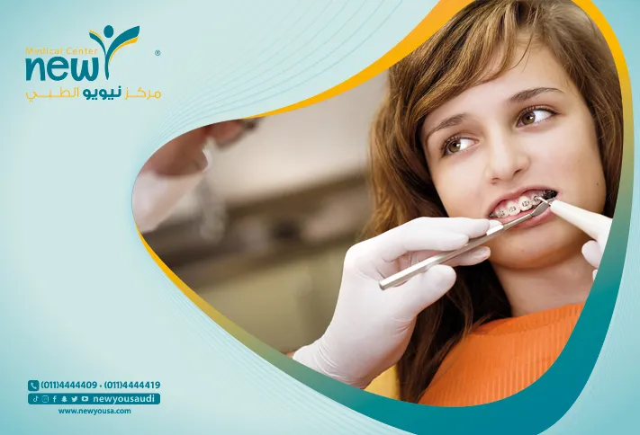 سبعه عادات قد تسبب اضرار على الأسنان