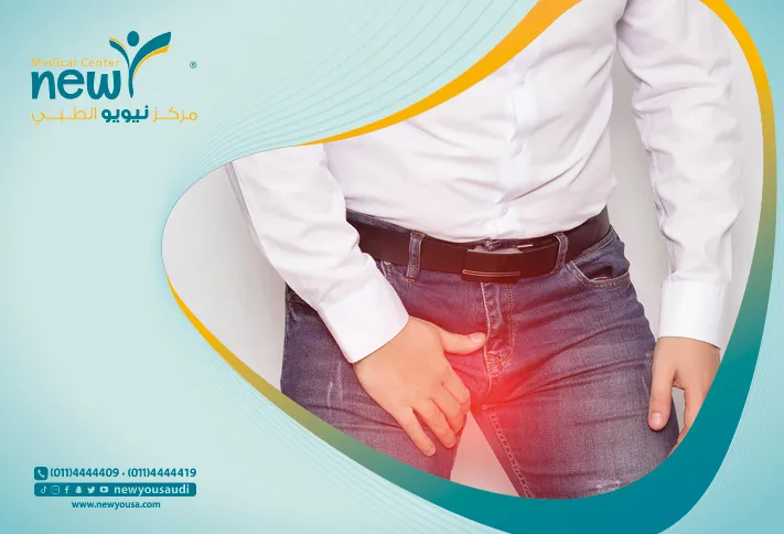 علاج دوالي الخصية تعرف عليه من خلال مركزنا الطبي في السعودية | نيويو