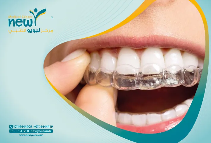 التقويم المتحرك كل ما تريد معرفته عنه و اكثر من خلال مركزنا الطبي في السعودية | نيويو