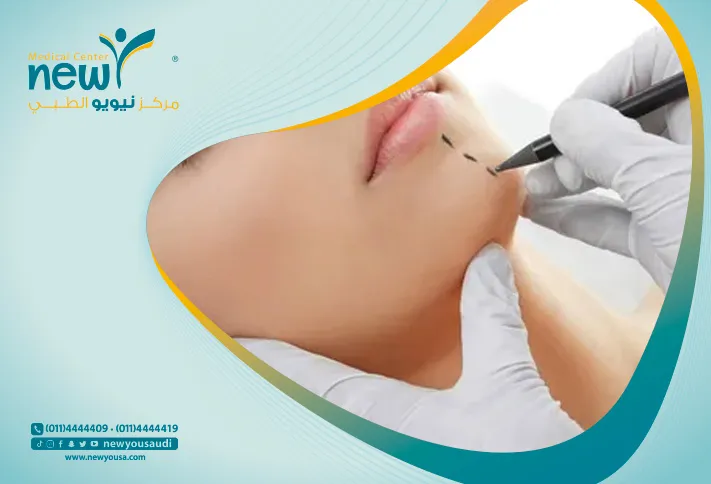 تجميل الوجة بالليزر كل ما تريد معرفته عنه من خلال مركزنا الطبي في السعودية | نيويو