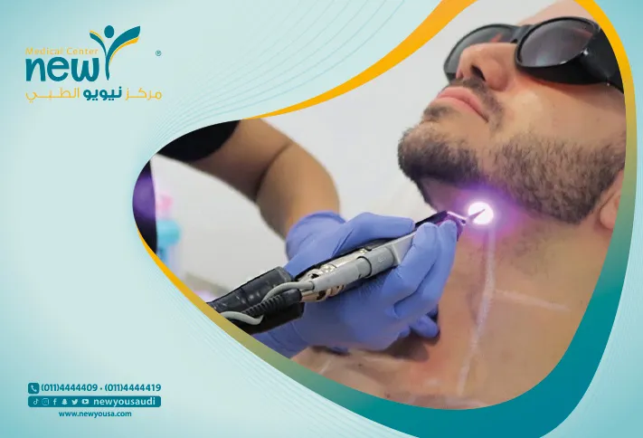 ليزر إزالة الشعر للرجال كل ما تريد معرفته عنه من خلال مركزنا الطبي في السعودية | نيويو