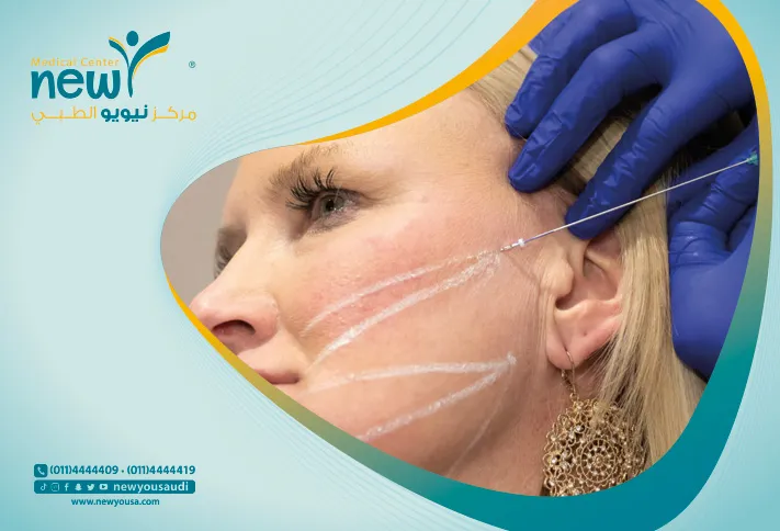 شد الوجه بالخيوط