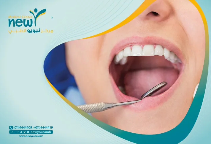 الم علاج قناة الجذر تعرف عليه من خلال مركزنا الطبي في السعودية | نيويو