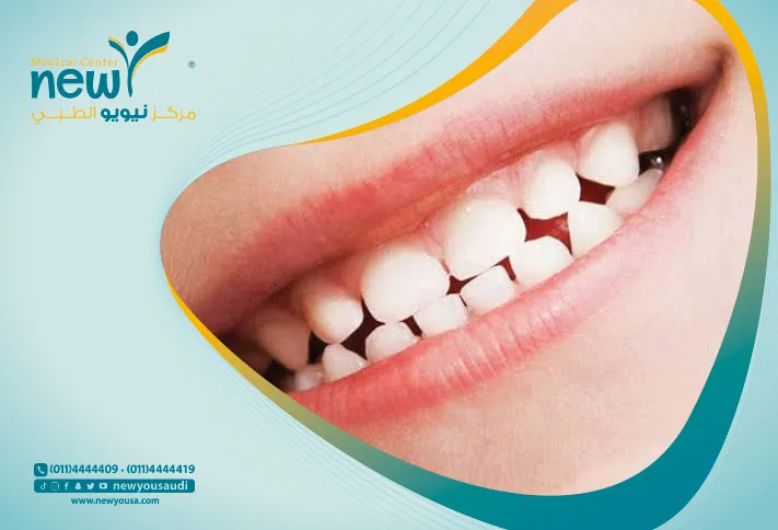 الأسنان اللبنية والدائمة  تعرف عليه من خلال مركزنا الطبي في السعودية | نيويو