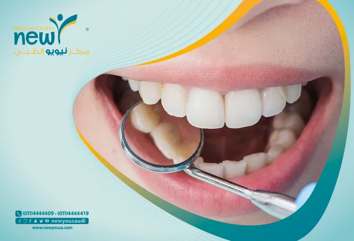 اسباب تسوس الأسنان والعادات الروتينية الضارة لها؟