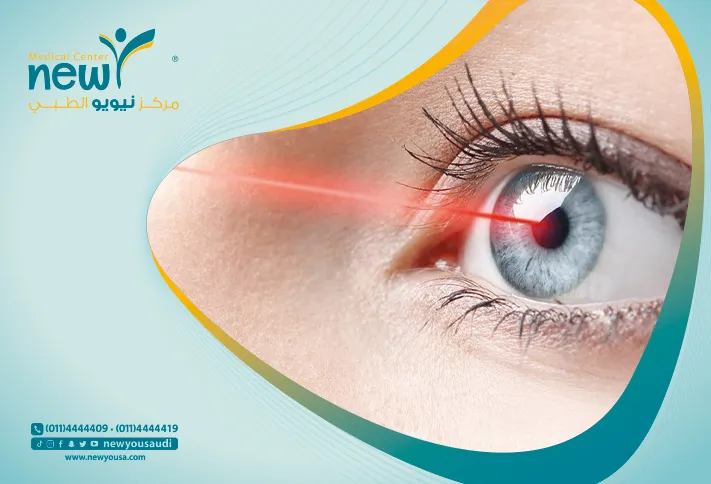عمليات تصحيح الإبصار كل ما تريد معرفته عنها من خلال مركزنا الطبي في السعودية | نيويو