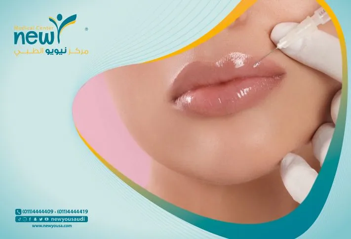 افضل دكتور فيلر شفايف بالرياض | مركز نيويو الطبي