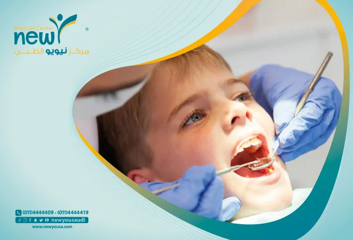 فحص الأسنان للأطفال تعرف عليه من خلال مركزنا الطبي في السعودية | نيويو