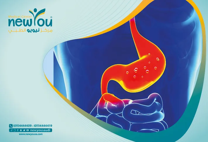 سعر عملية التكميم في السعودية سعر عملية التكميم كل ما عليك معرفته