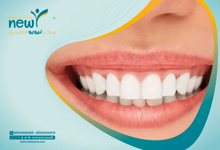 التصبغات اللثوية كل ما تريد معرفته عنها من خلال مركزنا الطبي في السعودية | نيويو