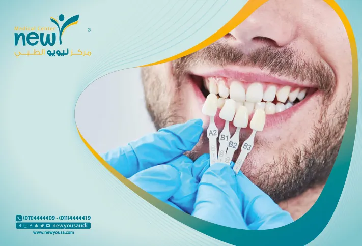انواع حشوات الاسنان الوقائية واسعار حشوات الاسنان في السعودية -نيويو